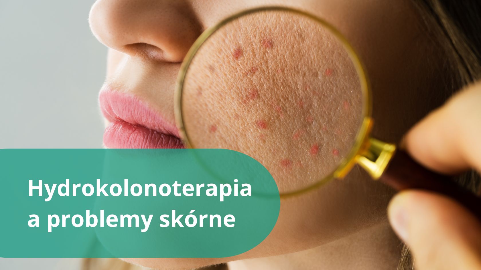 problemy skórne rozwiązane po hydrokolonoterapii